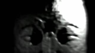 The True Psychedelic ВИD