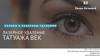 Лазерное удаление татуажа век. #татуаж #лазерноеудаление