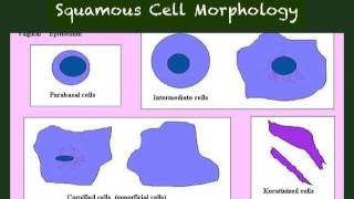 Vaginal Wet Mount Interpretation