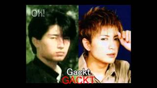 Johnny's Idol Jpop Japanese Male Plastic Surgery