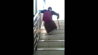 IVLOG 13|| AMPUTEE GIRL WALKING UP THE STAIRS