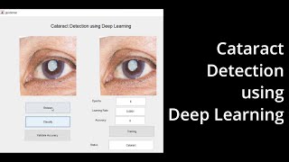 Cataract Detection using Deep Learning
