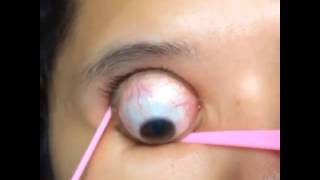 眼球 eyeball pop out 1
