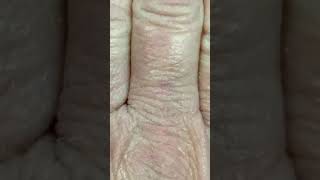1/19/20 My hands and feet burnt with frequencies while asleep in bed