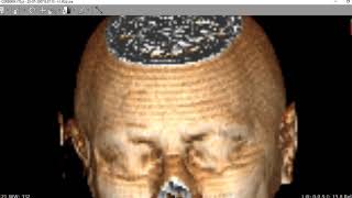 TUTORIAL COMO UTILIZAR RADIANT DICOM VIEWER