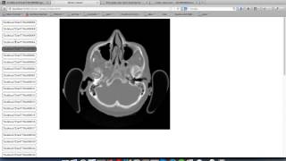 dicom web view