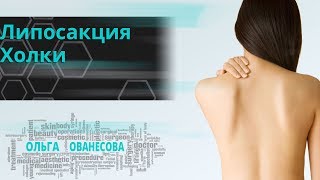 Липосакция холки✦Ованесова Ольга