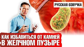 КАМНИ В ЖЕЛЧНОМ ПУЗЫРЕ: Как избавиться?
