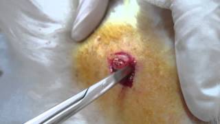 Benign tumor in dogs. Жировик у собаки.