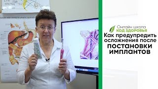 Как предупредить осложнения после постановки имплантов
