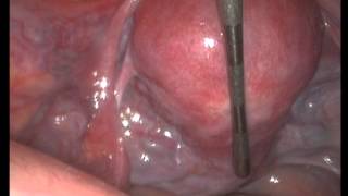 Teaching medical students a pelvic exam