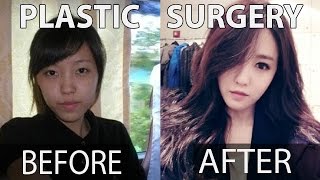 10 KPOP STARS BEFORE AND AFTER PLASTIC SURGERY | MisuP