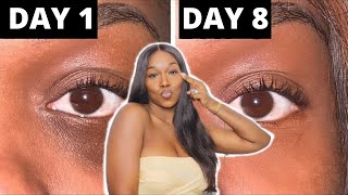 Faire disparaître ses cernes sous les yeux - SAY BYE TO DARK CIRCLES ??‍♀️