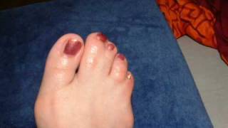 webbed toes