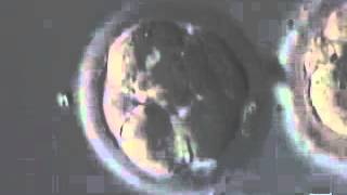 Zygote development