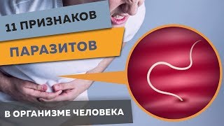 11 признаков паразитов в организме человека! ПРОСТОЙ ТЕСТ.  Что делать, чтобы их вывести?