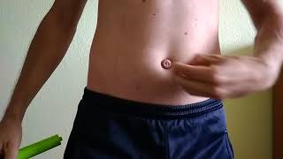 Navel pump
