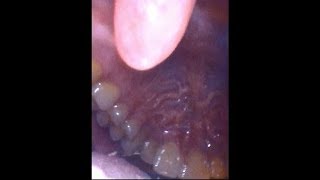 Inside my mouth and throat with endoscope vore