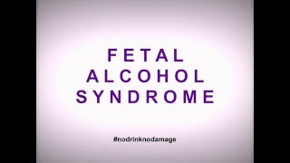 Fetal Alcohol Syndrome