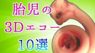 【神秘】最新3Dエコー技術動物の赤ちゃんがママのお腹にいる画像10選
