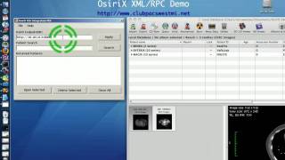 OsiriX - XML/RPC Interface demonstration