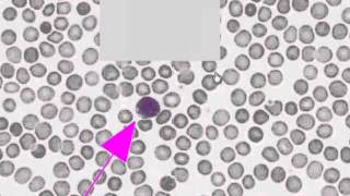 Histologia - Fortis de Sangre