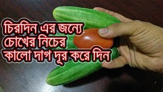 Cucumber – Tomato দিয়ে চোখের নিচের কালো দাগ দূর করুন আজীবন এর জন্যে  bangla health tips [HD]