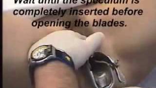 Examination of Female vagina speculum exam