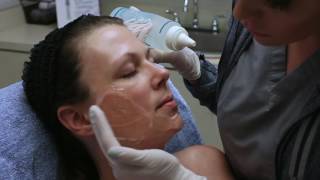How does the IPL Photofacial work? Watch and learn! | Seiler Skin