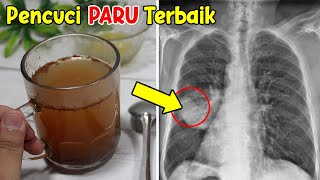 ALHAMDULILLAH... TIDAK PERLU BIAYA MAHAL, CUKUP MINUM INI, RACUN DAN KOTORAN DIPARU LANGSUNG BERSIH