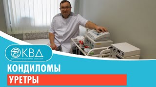 Кондиломы уретры. Клинический случай №2