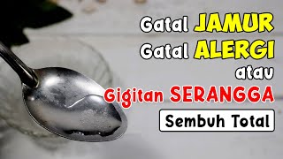 HANYA DIOLESI INI, GATAL-GATAL KRONIS / AKUT, ALERGI, GIGITAN SERANGGA SEMBUH SEKETIKA 