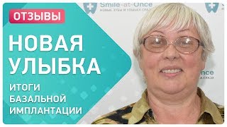 Новые зубы за 4 дня и с пожизненной гарантией в клинике Smile-at-Once