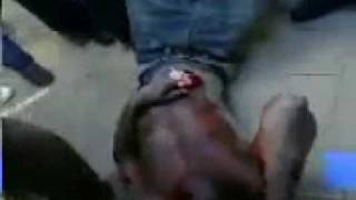 Evidence of Libya torture BENGHAZI  _Feb17   [libyasos]