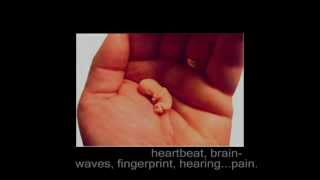 Life at 8 Weeks - Abortion Video