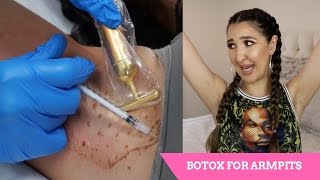 Getting Botox IN MY ARMPITS!!!