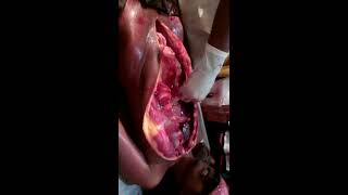 Autopsy(Post Mortem) of a male dead body of OPC poisoning part II
