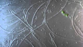 Bacteria - Bacillus, filamentous bacteria