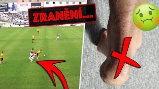ZRANĚN NA 3 TÝDNY *NECHUTNÝ