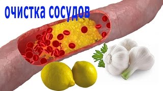★Как  очистить сосуды от ХОЛЕСТЕРИНА. 4 рецепта ОЧИЩЕНИЯ СОСУДОВ чесноком и лимоном.