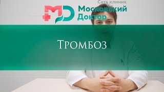 Тромбоз подкожных вен. Тромбофлебит