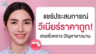 แปะฟันขาว วีเนียร์ราคา ถูก !! ได้ผลหรือไม่ แชร์ประสบการณ์ตรงจากคนไข้