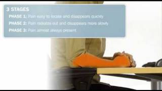 What is RSI and what can you to do to prevent it? (www.explania.com)