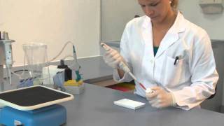 Immunoblot-Testsysteme für die Autoimmundiagnostik: Labornachweis autoimmuner Erkrankungen