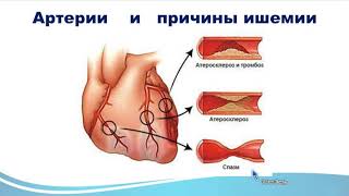 Заболевания сердечно сосудистой системы. Восстановление прибором БРТ
