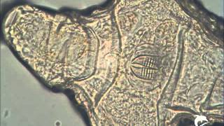 Rope drop Alien - Toxoplasma gondii? - 17-05-2012