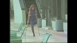 Amputee Woman Danielle 2 SAK 1
