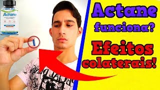 Actane Funciona? Actane Como Usar? Actane EFEITOS COLATERAIS (actane depoimento)