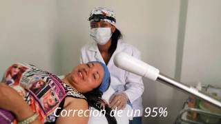 REMOCIÓN DE SIRINGOMAS