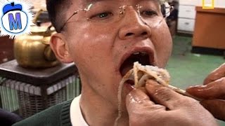 9 Weirdest Things People Have Swallowed